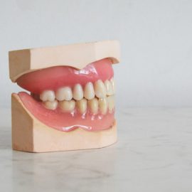 Implant zęba Kraków